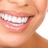 perlaal 85