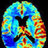 neuroimaginguoe